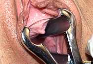 extreme 2000pixels close-ups