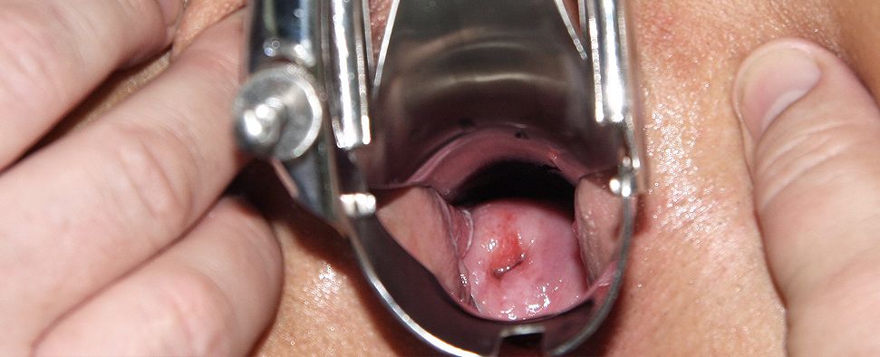 Rectal examination with fingers